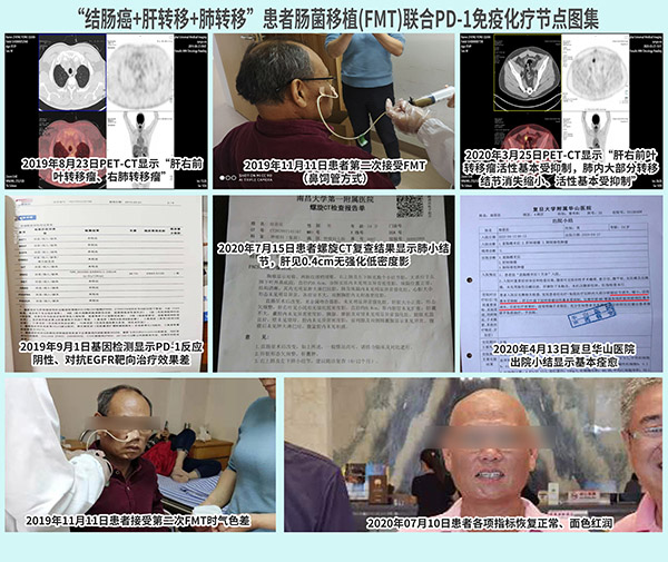 郑勇泉资料前后对比-report-net2.jpg